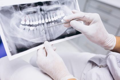 Leczenie pacjentów z patologicznym starciem zębów